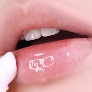 Solid-In Ceramide Lip Essence – Torriden | Bálsamo de labios