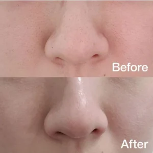 Zero Pore Pad – Medicube | Toner pads para poros y puntos negros